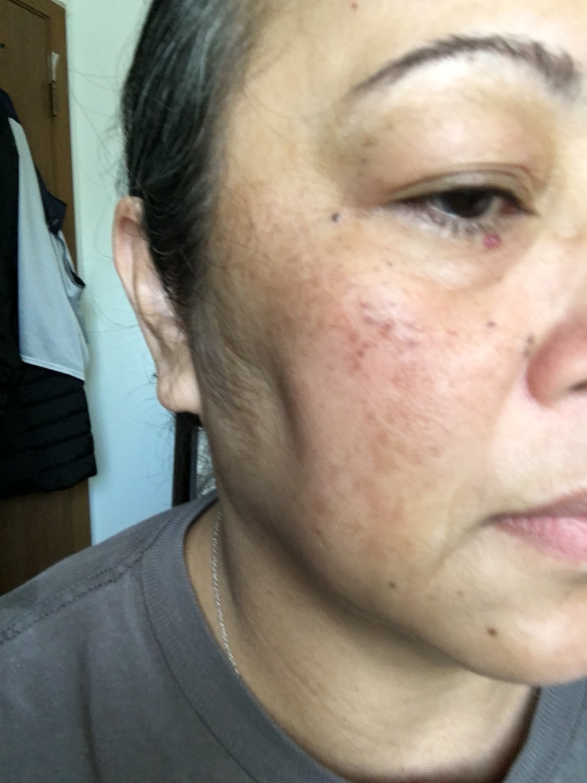 The Spot Cream review photo by Empresson E.