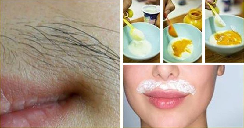 How To Remove Hair From Your Upper Lip With 7 Home Remedies By