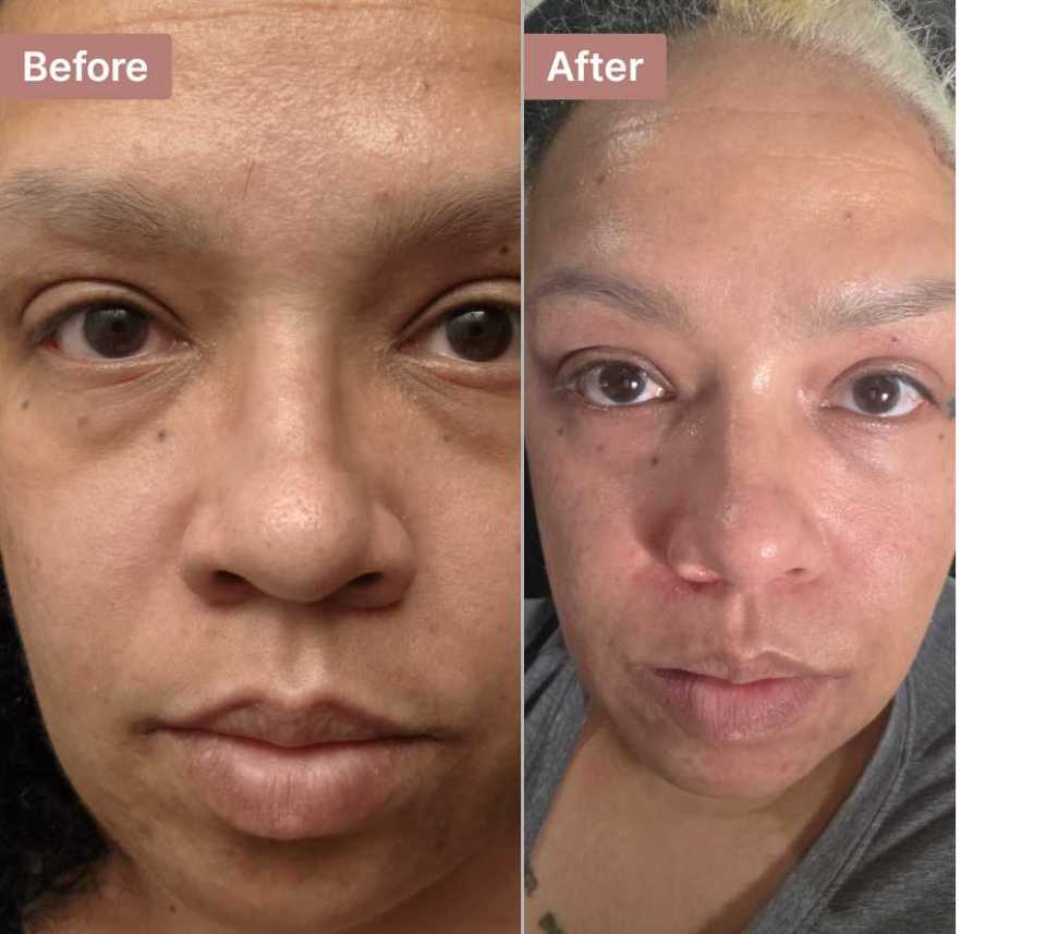 Customer photo