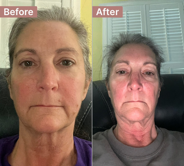 The Anti-Aging Cream review photo by Michelle S.