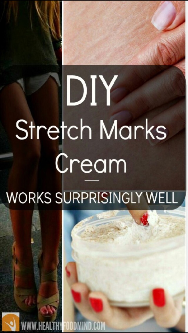 Diy Stretch Mark Cream And Cellulite Fighter - Musely