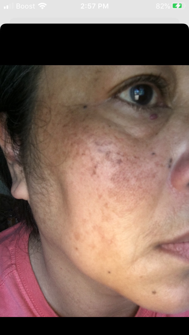 The Spot Cream review photo by Empresson E.