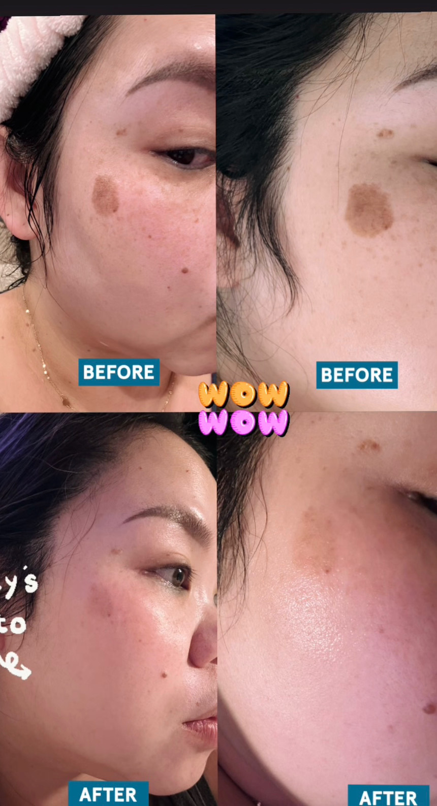The Spot Cream review photo by Vanessa V.