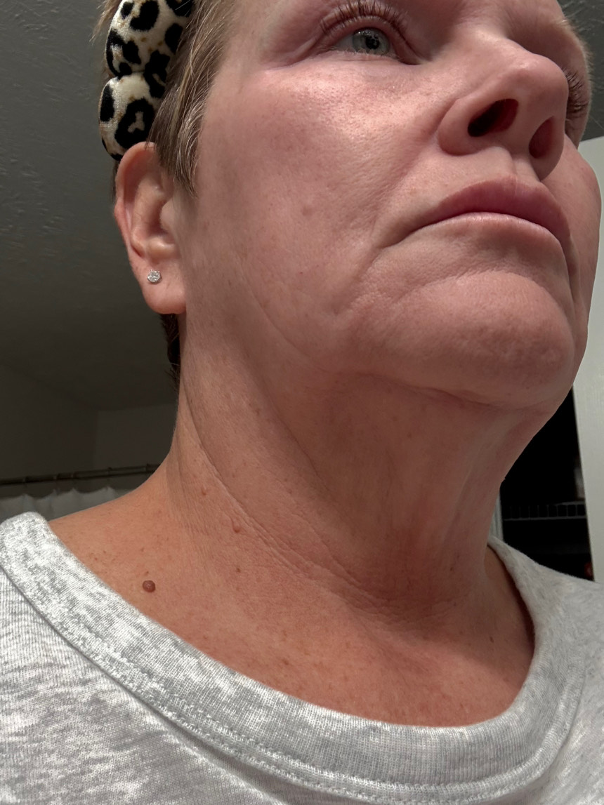 Customer photo