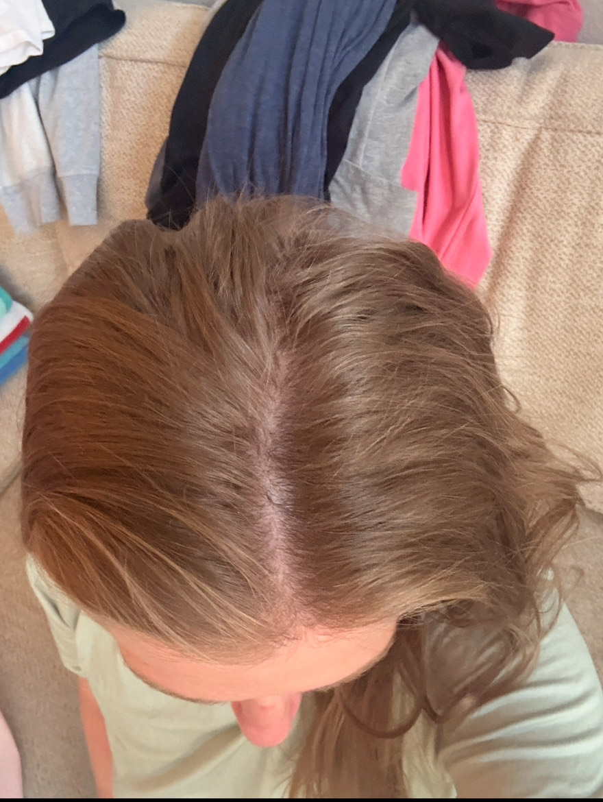 The Hair Pill review photo by Jolene S.
