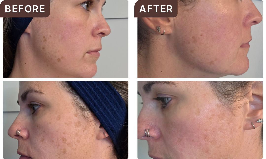 Shannon C. -- before and after, 8 weeks