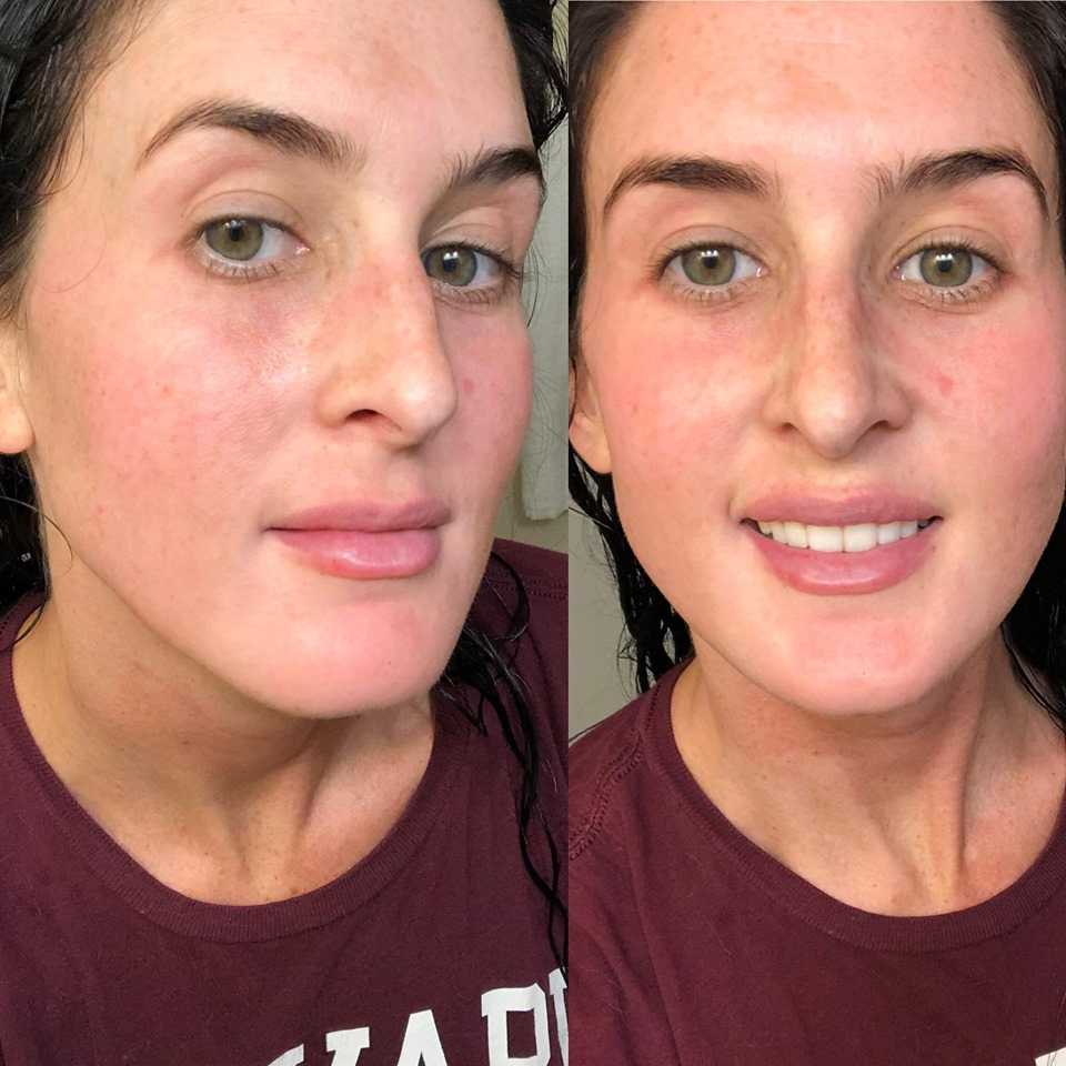 Customer photo