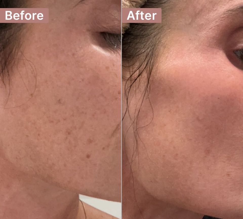 The Spot Cream review photo by Laura S.