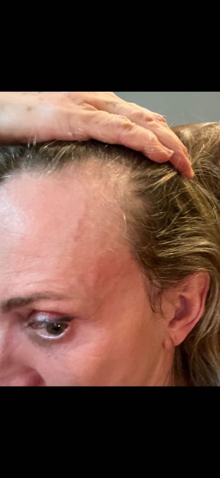 The Hair Topical Solution - Classic review photo by Lisa S.