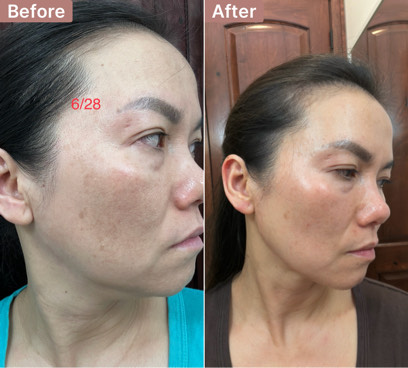 Ailene's story