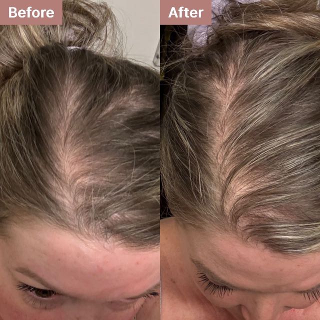 Debbie M.'s story
