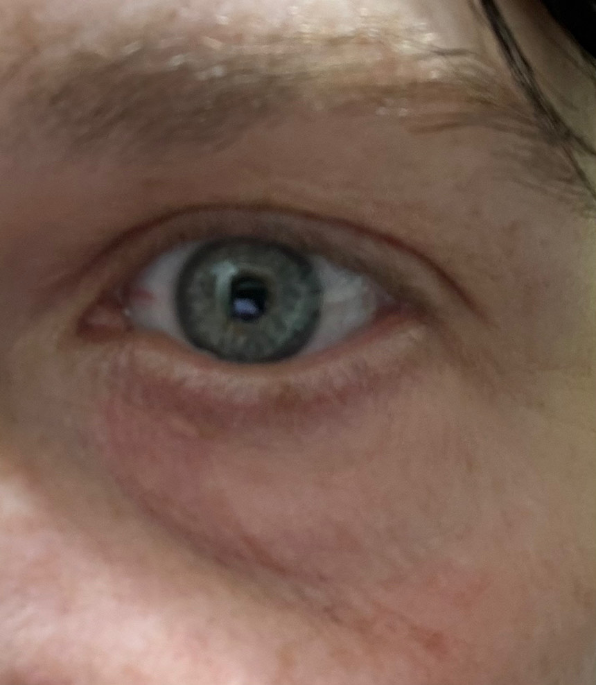 The Eye Serum review photo by Julie T.