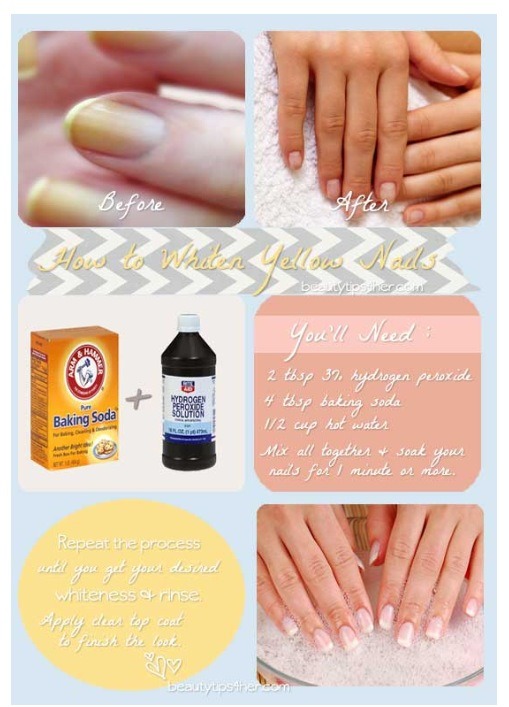 How To Whiten Yellow Nails - Musely