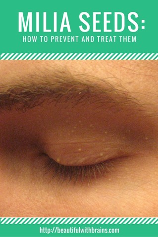 How To Prevent And Treat Milia Seeds By Nunita Nice Musely