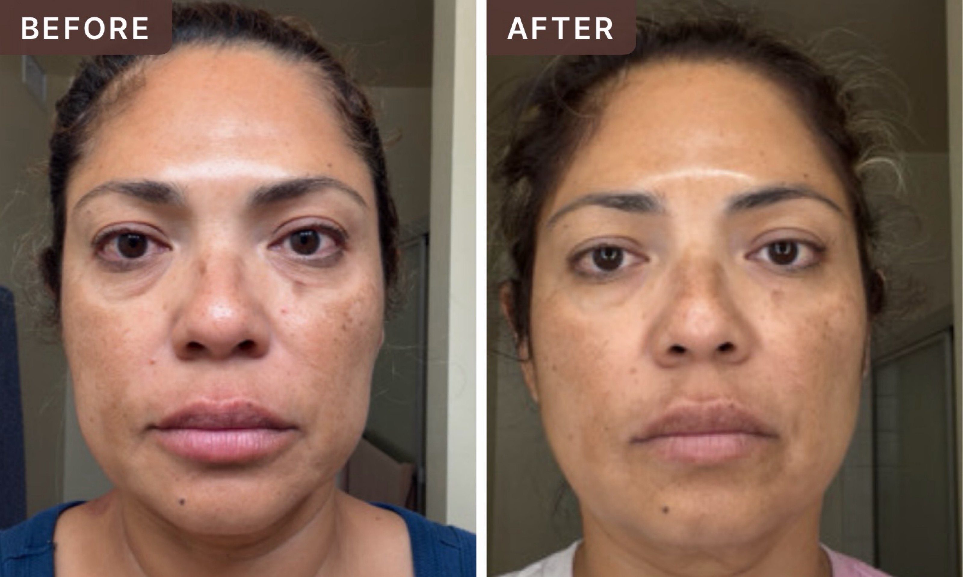 Zulema S. -- before and after, 8 weeks