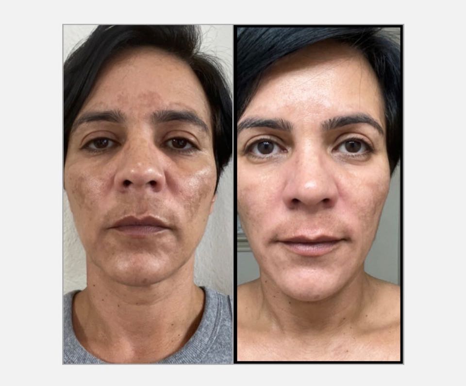 The Spot Cream review photo by Ruthy C.