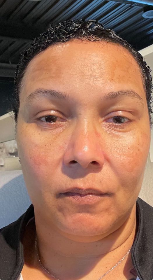 The Spot Cream review photo by Johncina H.