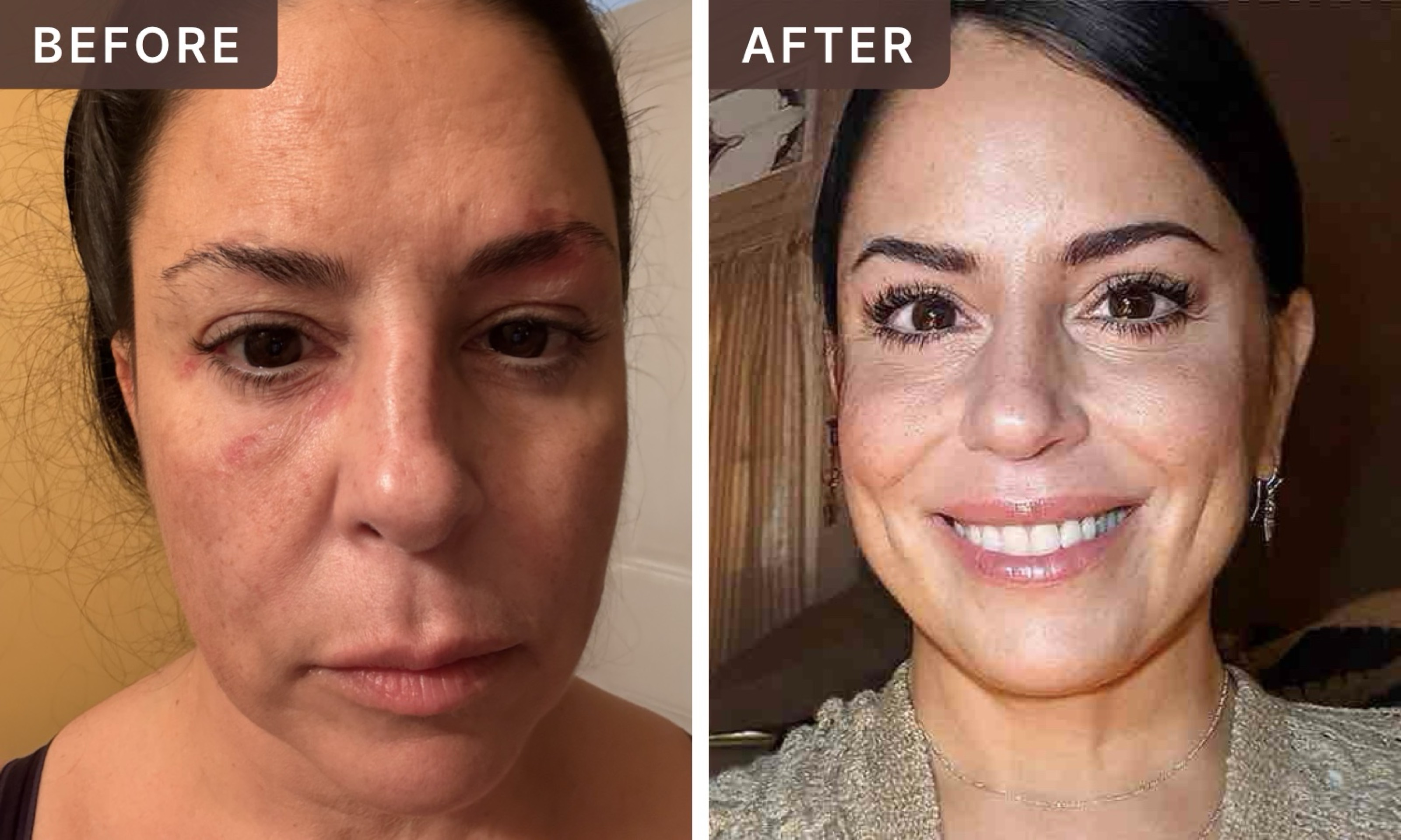 Sarah G. -- before and after, 8 weeks