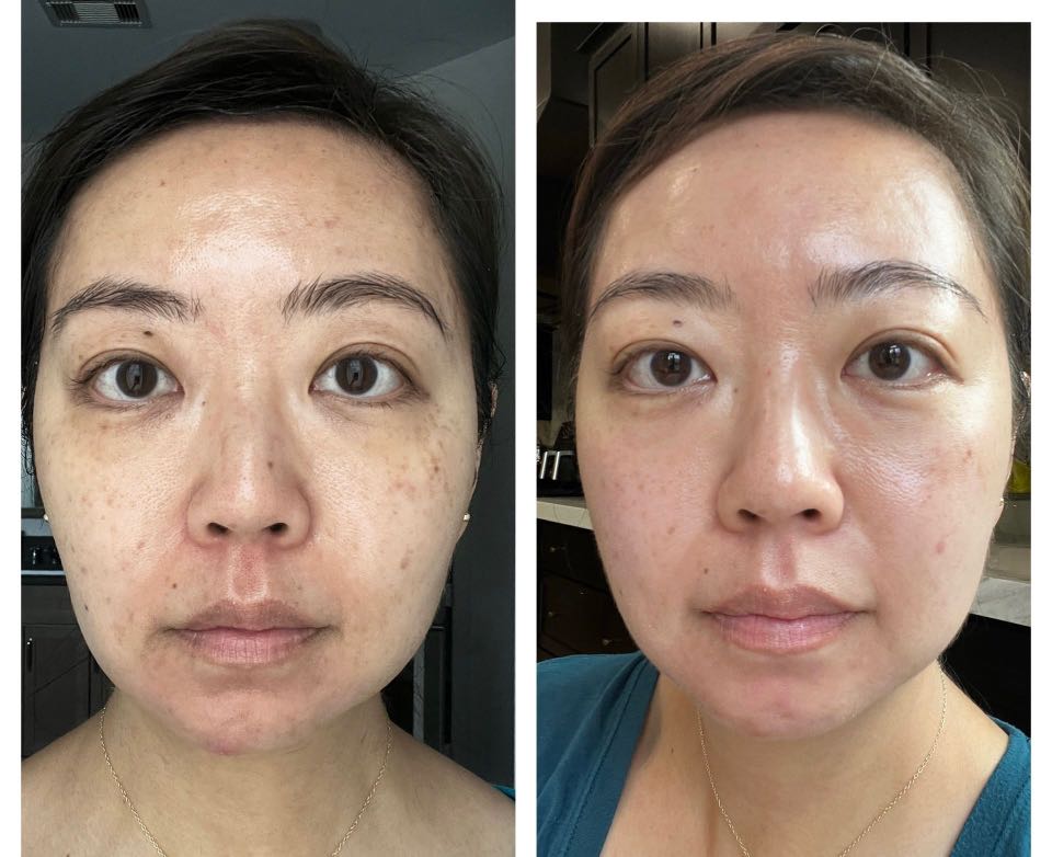 The Spot Cream review photo by Dara W.