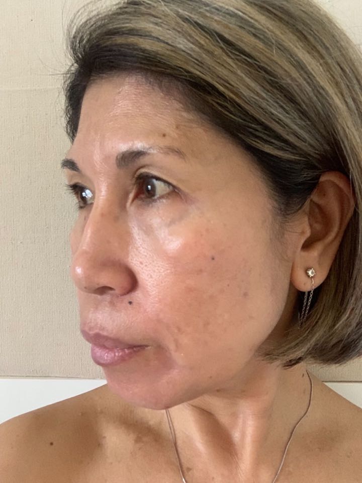 The Spot Cream review photo by Dolores A.