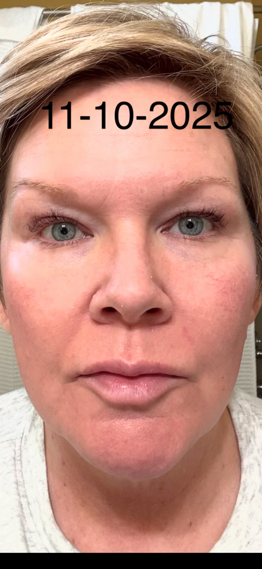The Cell Repair Serum review photo by Melissa R.