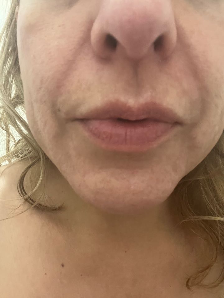 Customer photo