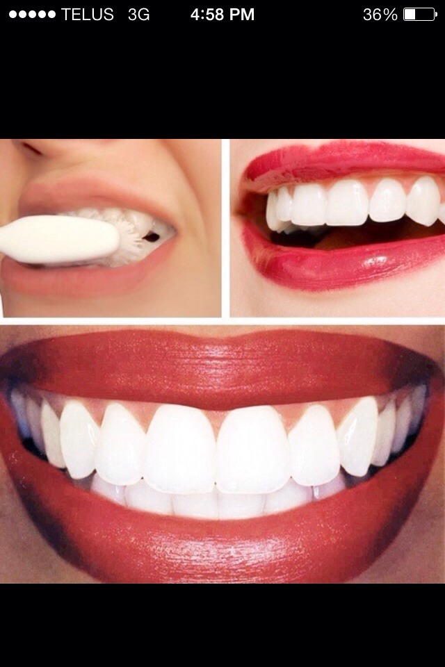 How To Whiten Your Teeth In The First Treatment Musely