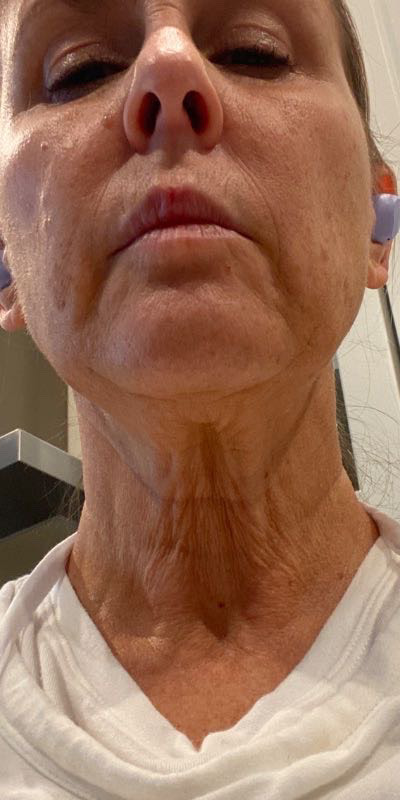 The Neck Cream review photo by Nicole I.