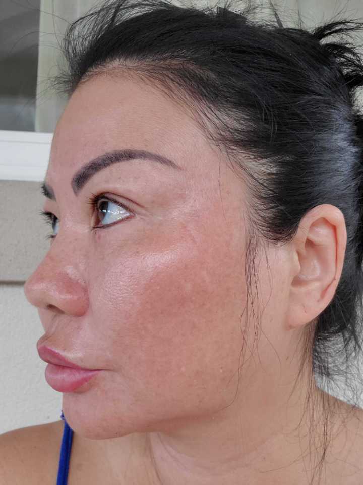 The Spot Cream review photo by musely1009p T.
