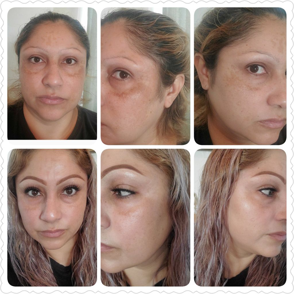 Does Musely Really Work Musely Reviews Very Pleased With Results