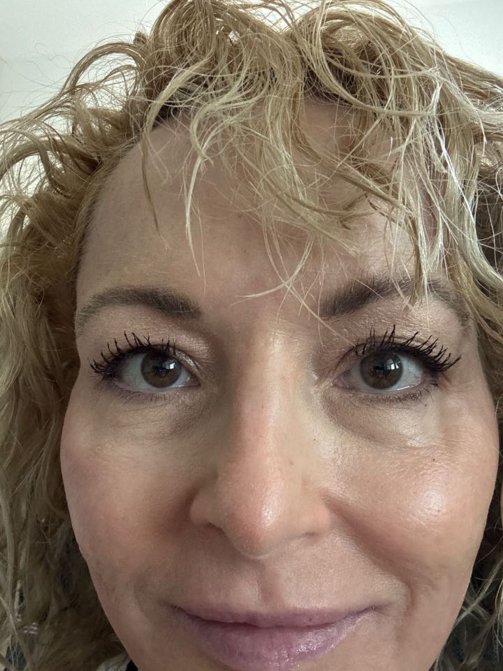 The Eye Serum review photo by Laura L.