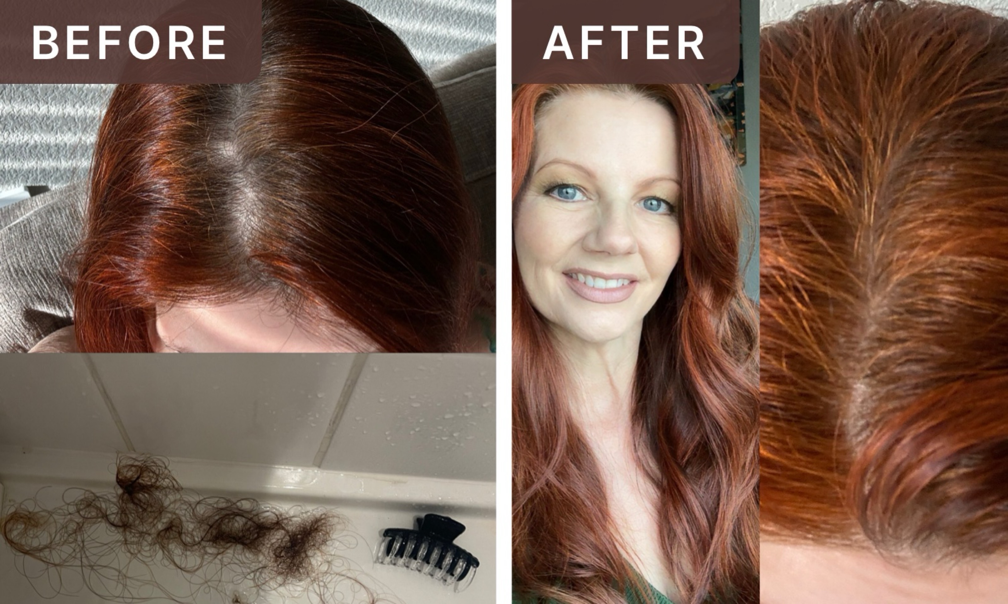 Rachael F. -- before and after, 8 weeks