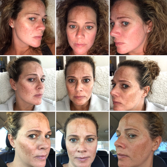 Real LifeChanging Results With Musely FaceRx MuselyWorks