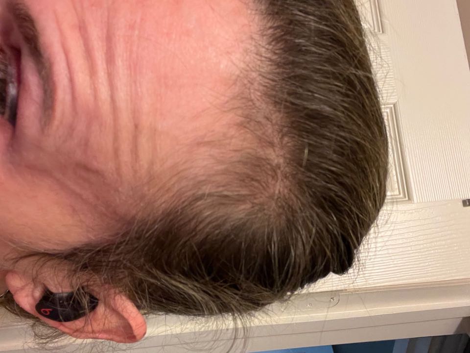 The Hair Topical Solution - Classic review photo by Lisa S.