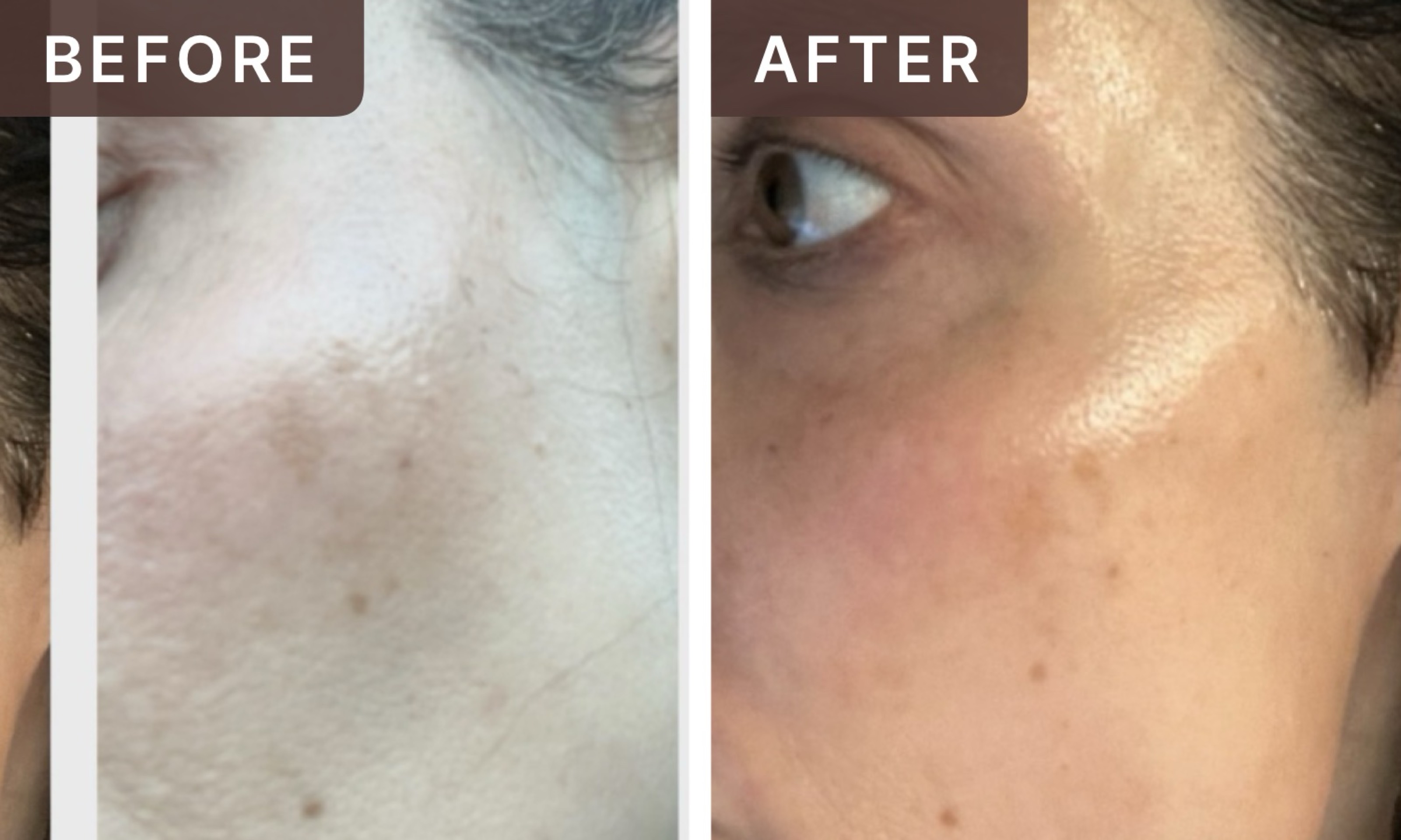 Briana R. -- before and after, 8 weeks