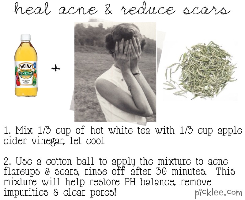 ๐ 12 amazing natural beauty remedies ๐ ๐ 12 Amazing Natural Beauty Remedies ๐ - Musely