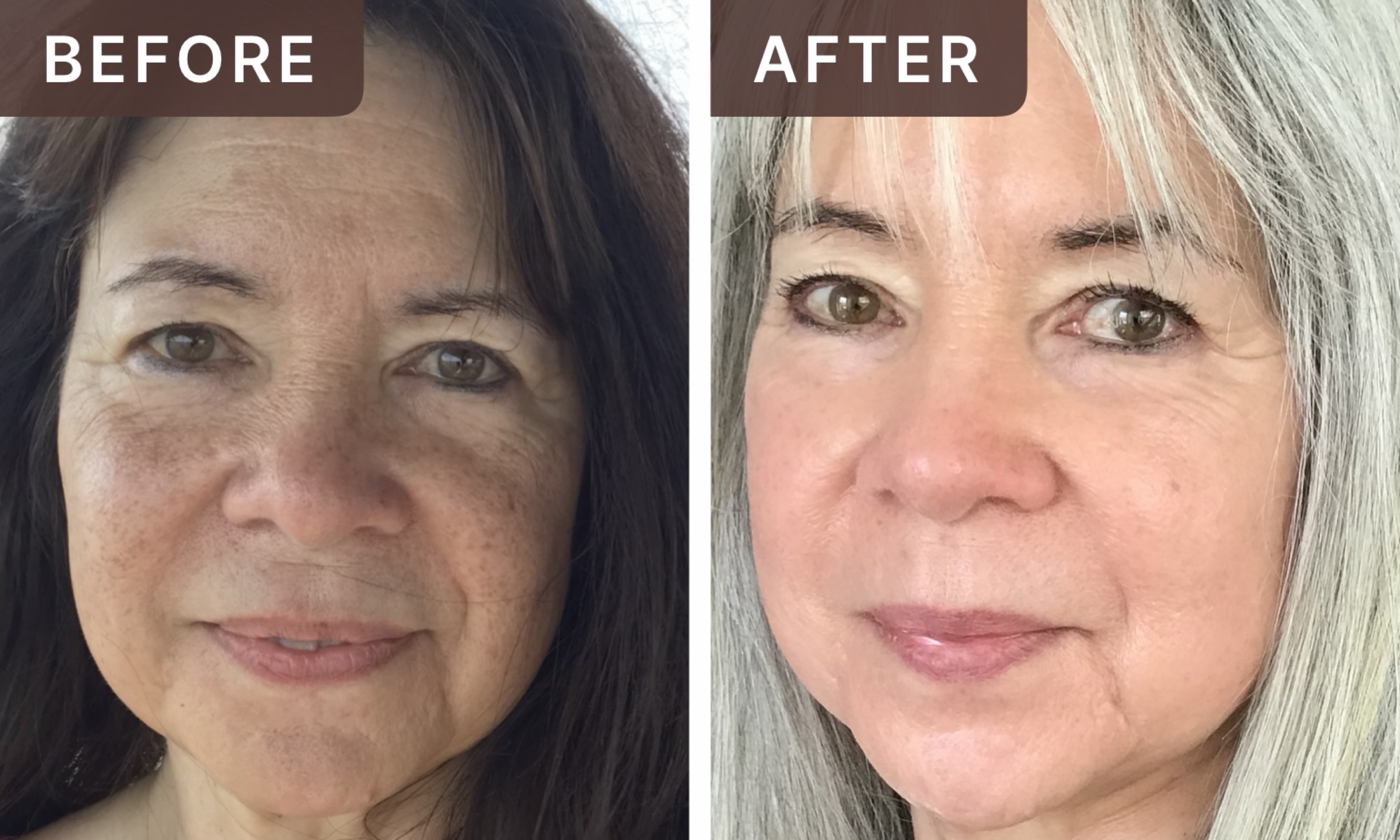 Kay M. -- before and after, 8 weeks