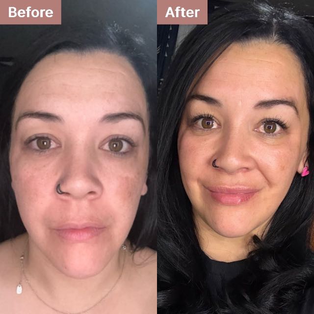 Laura O.'s story
