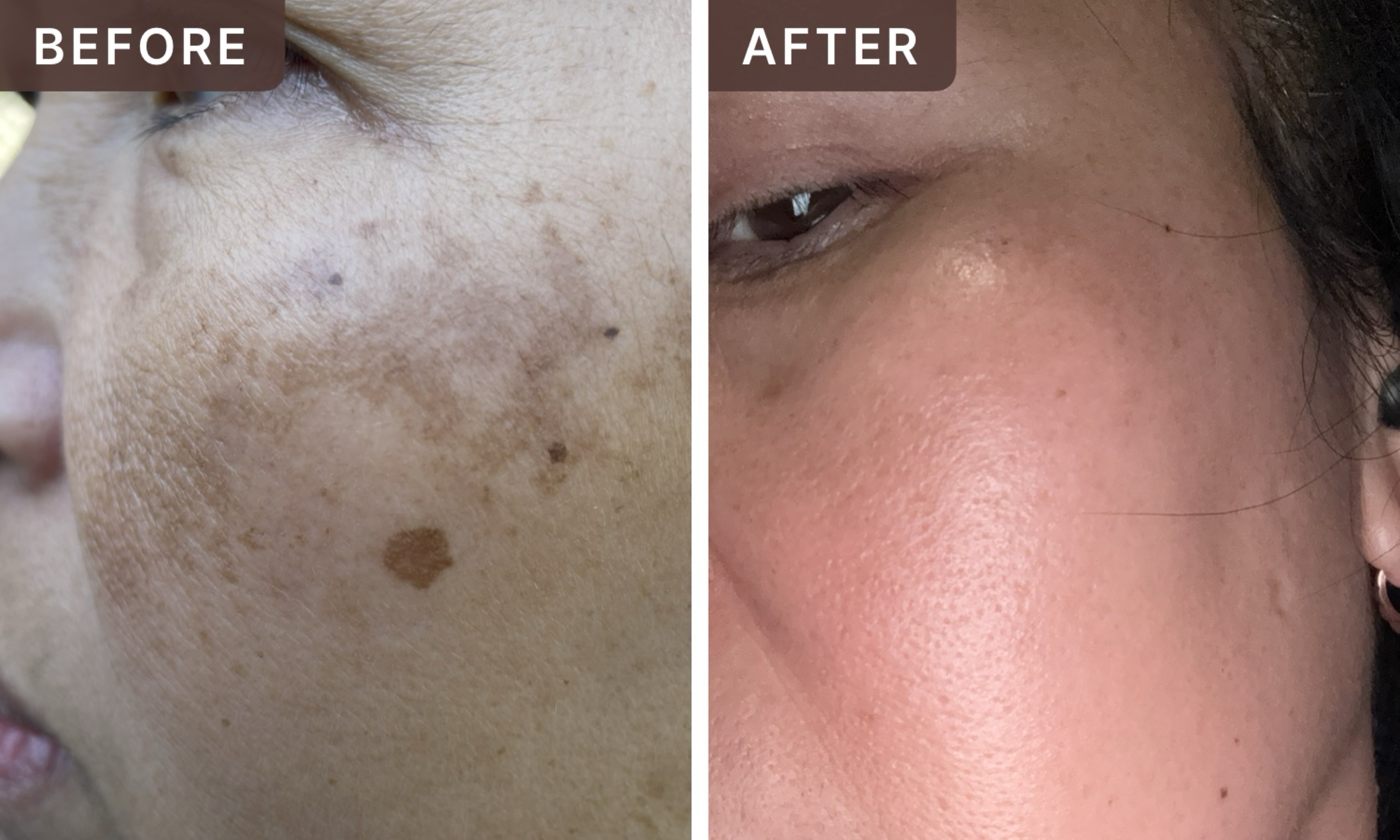 Riza L. -- before and after, 8 weeks