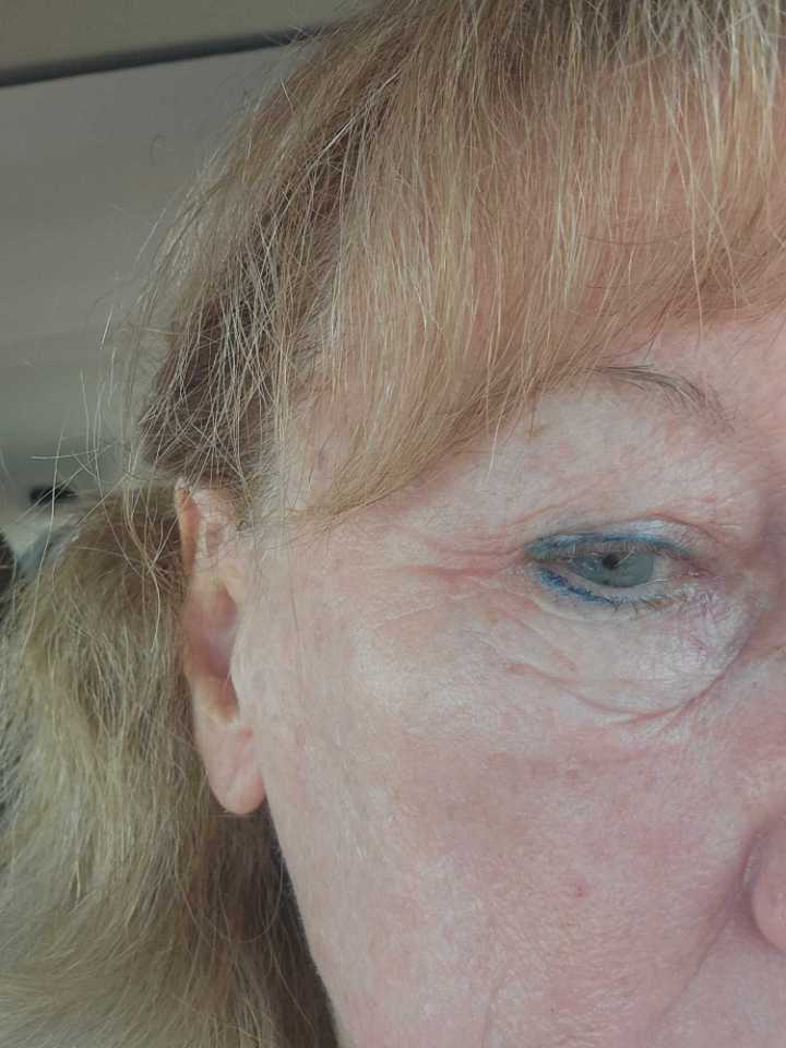 The Eye Serum review photo by Sandie S.
