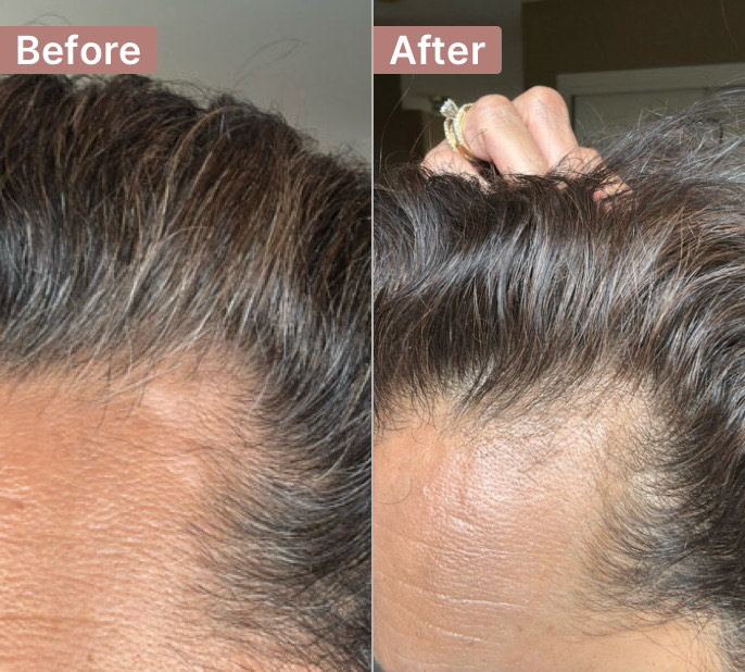 The Hair Pill review photo by Sabrina H.