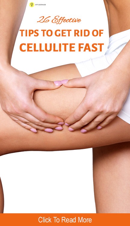What Causes Cellulite How To Get Rid Of Cellulite Fast 26