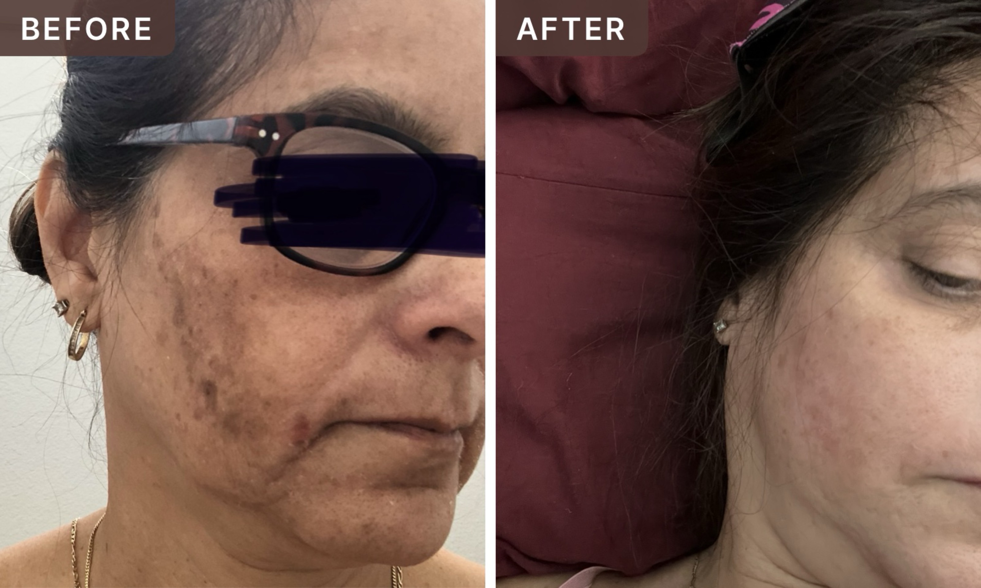 maribel l. -- before and after, 8 weeks