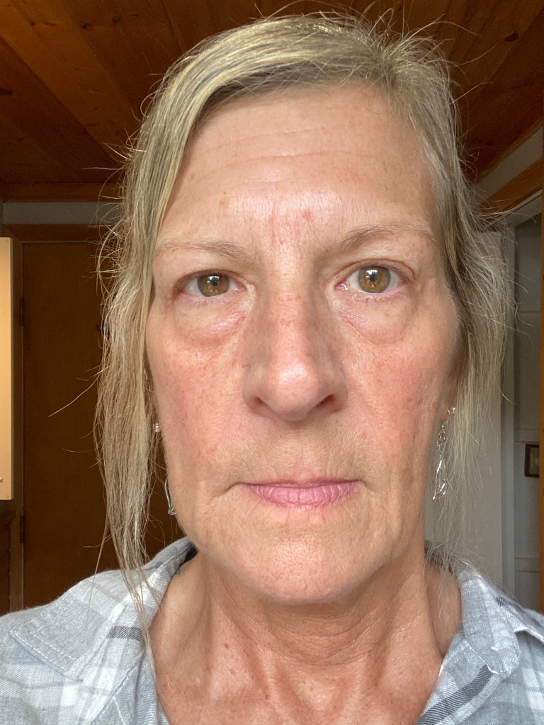The Eye Serum review photo by Teresa R.