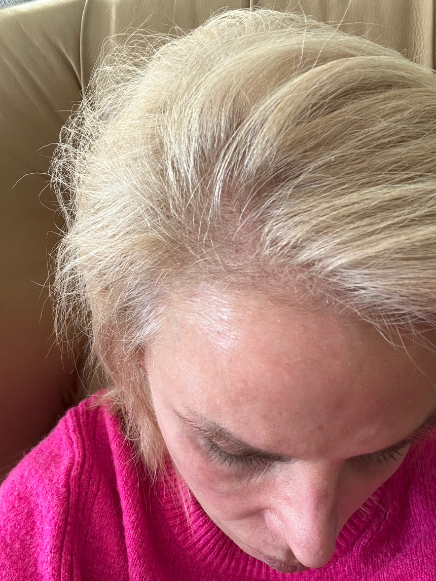 The Hair Pill review photo by Carol S.