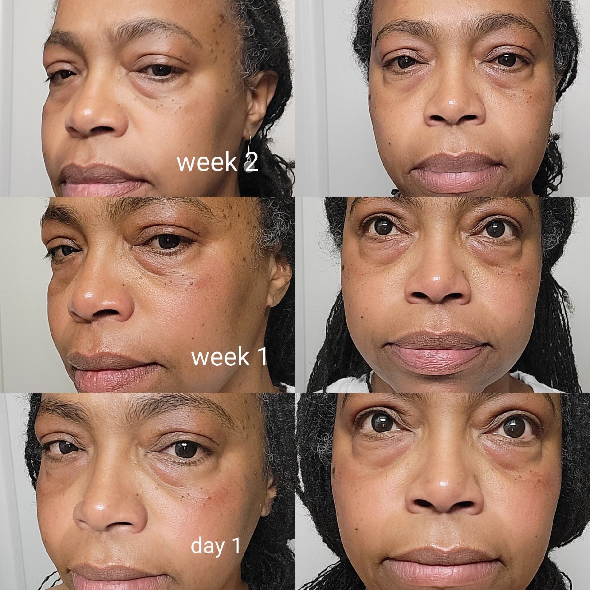 Post attachment 1