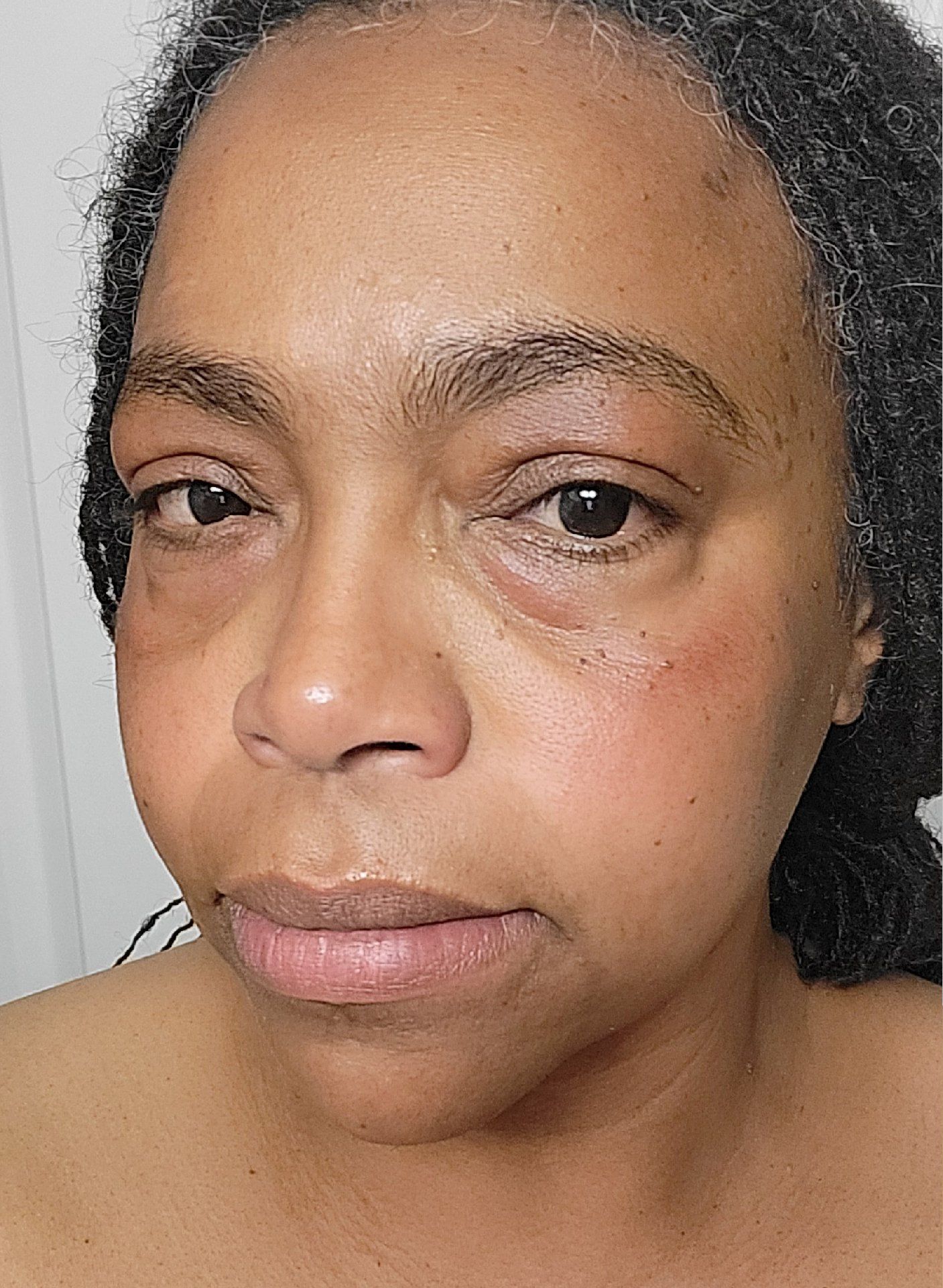 Post attachment 2
