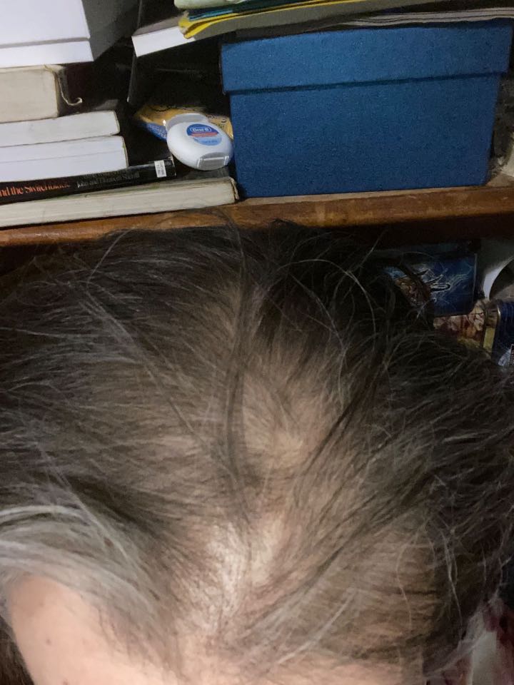 The Hair Pill review photo by Lori N.