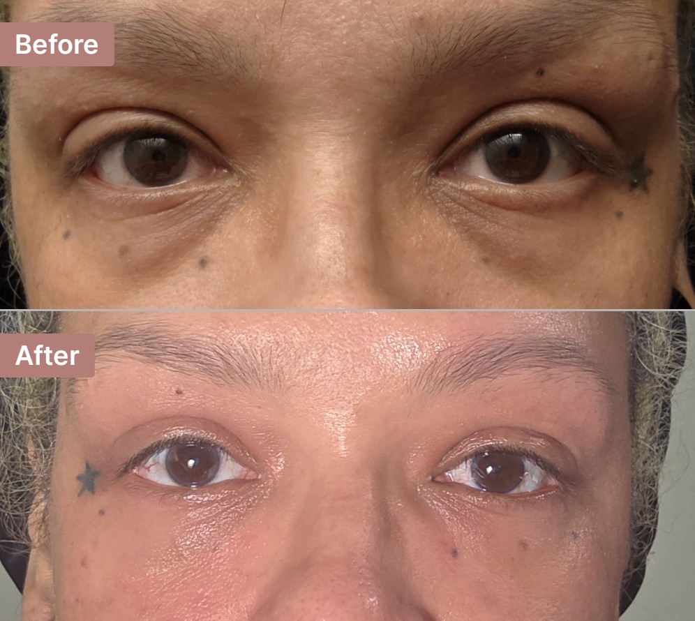 The Eye Serum review photo by Cammie S.
