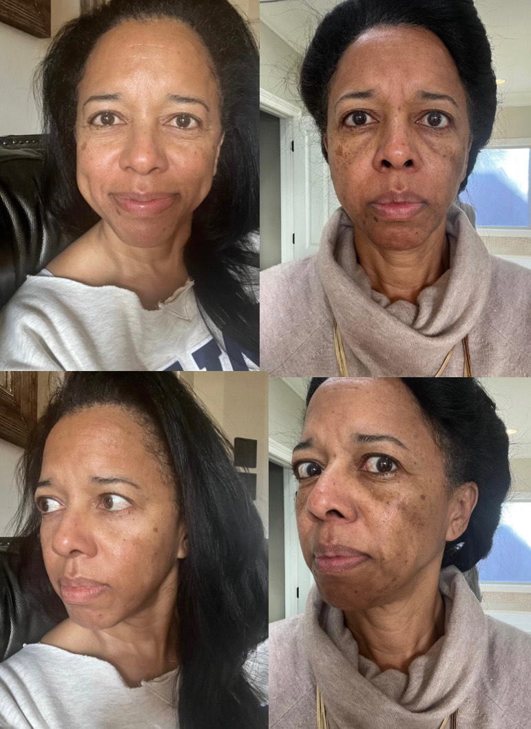 The Spot Cream review photo by Shay G.